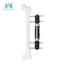 mini external fixator