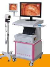 High Quality China digital colposcope Video Colposcope Camera colposcope