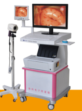High Quality China digital colposcope Video Colposcope Camera colposcope