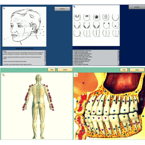 innovative bio-resonator 3d nls quantum body health analyzer