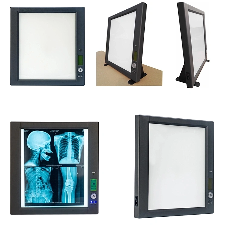 Low Price Digital Triple Durable LED X Ray Film Viewer 3 in 1 Negatoscope