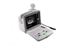 Digital Ultrasound Scanner