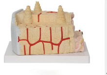 A-Bone structure model