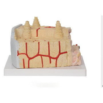 Modèle de structure A-Bone