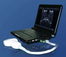 Portable Ultrasonic Diagnostic System (HY260)