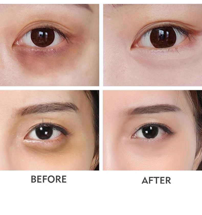 Private Label Hydrating Anti Wrinkle Cream Remove Dark Circle Lifting Eye Gel Cbd Eye Cream