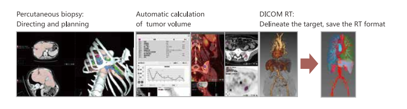 PET-Computertomographie PET Computed Tomography