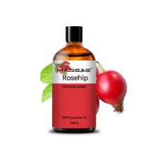 Prévention de la perte de cheveux Croissance des cheveux Rosehip en gros Rosehip renforcement de l&#39;huile de cheveux