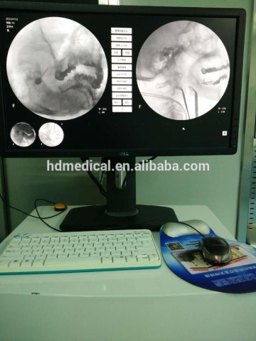 Miniview C-Arm SystemSpinal Carm