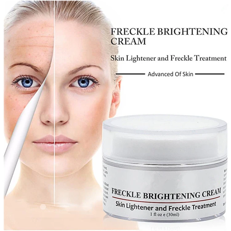 OEM Whitening Cream Freckle Remover Skin Brightening Spot Treatments Cream