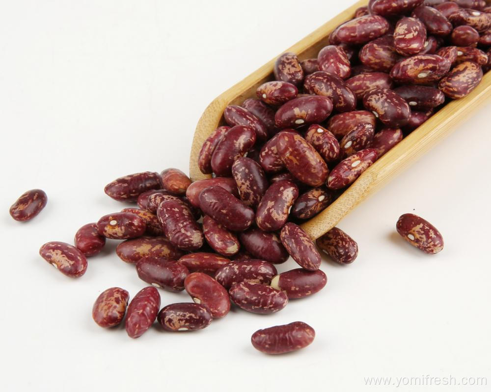 Kidney Beans During Pregnancy