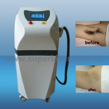 mini IPL machine