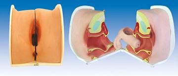 Contraceptive Guidance Model