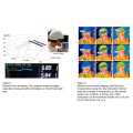 Suyzeko 810NM Capacete de fotobiomodulação infravermelha neuroterapia Máquina de fotobiomodulação transcraniana