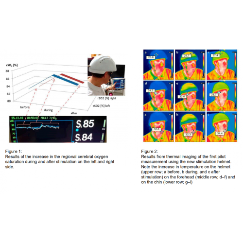 Suyzeko 810nm Infrared Photobiomodulation Helmet Neuro Therapy Transcranial Photobiomodulation Machine