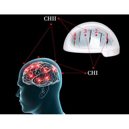 ziekenhuiskliniek hersenlicht gemoduleerde headset infraroodhelm laserhelm