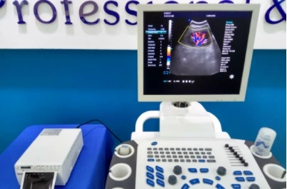 Trolley Color 3D/4D Doppler Human Pregnancy Ultrasound Machine