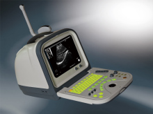 Portable Ultrasonic Diagnostic System ?(HY5522)