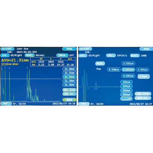 Escáner de pachimétrico oftálmico A-Scan