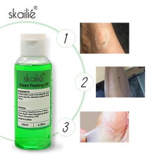 OEM/ODM Green Peeling Oil Extra Strength Organic Whitening Skin Care