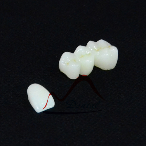 Anterior and posterior Full zirconia restorations