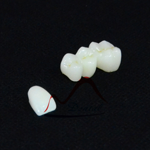 Full Solid Zirconia Ideal for Posteriors