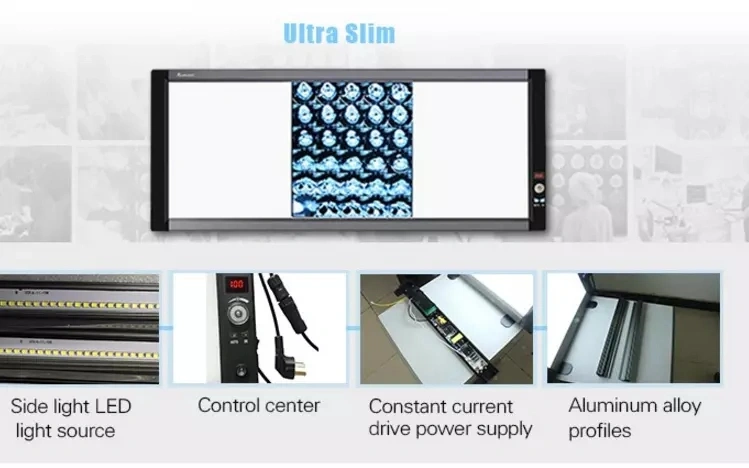 Ultra Thin Single Panel LED Xray Film Viewer Negatoscope