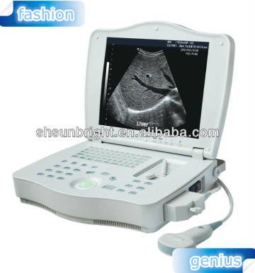 three dimension laptop ultrasound