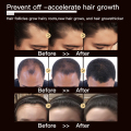 Sérum de croissance des cheveux de la perte de cheveux anti-cheveux
