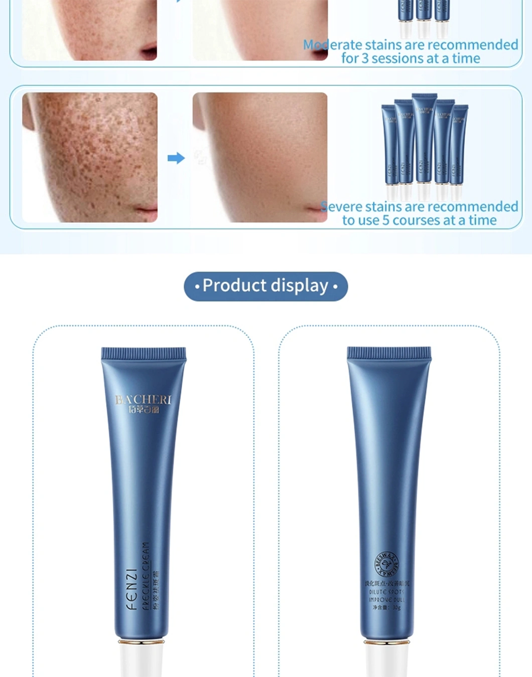 Wholesale OEM Private Label Freckle Cream for Fade Dark Spot