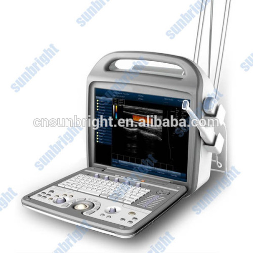 Compact Color Doppler Portable Ultrasound Scanner