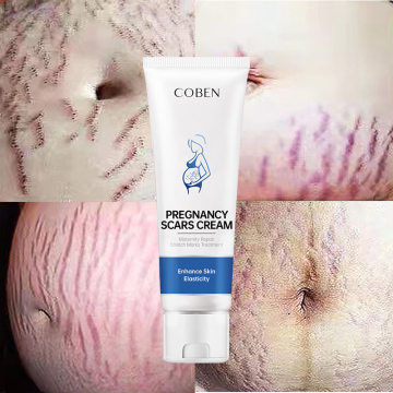 Quickly Effective Scar Removal and Acne Mark Repair Cream