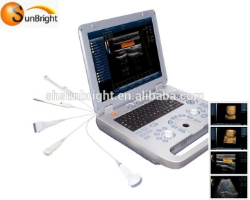 portable color doppler & laptop doppler ultrasound system