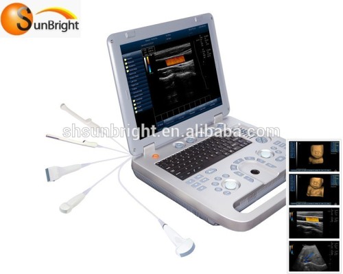 Full digital hospital portable ultrasound doppler