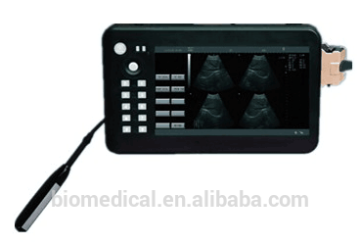 Portable Ultrasound Scanner Animal Handheld Palm Ultrasound Scanner