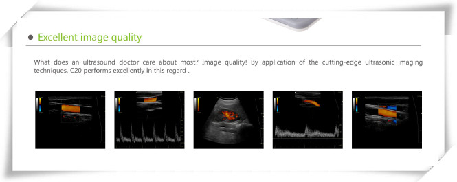 3.5 MHz Micro-Convex Transducer for Portable Color Doppler (PRO-CDS500)