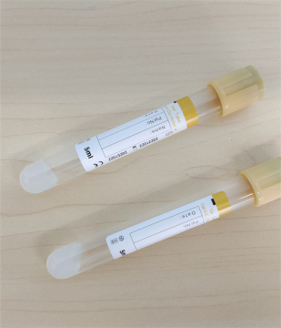 Gel & clot activator tube