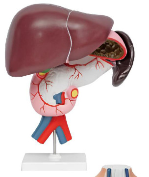 Celiac artery with cloth