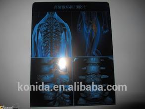 medical x-ray film,medic thermal imaging equipment agfa x-ray film kodak xray film