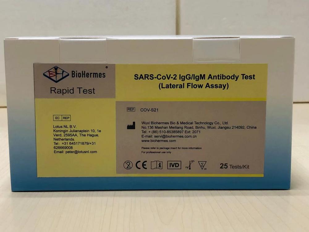 Uji Cepat Immunoglobulin M COVID-19