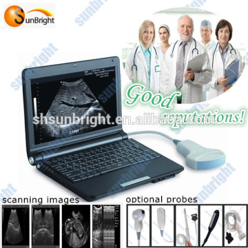 PC based ultrasound scanner