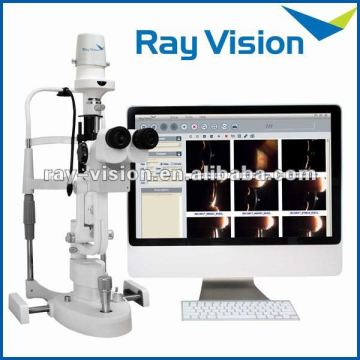 Digital slit lamp