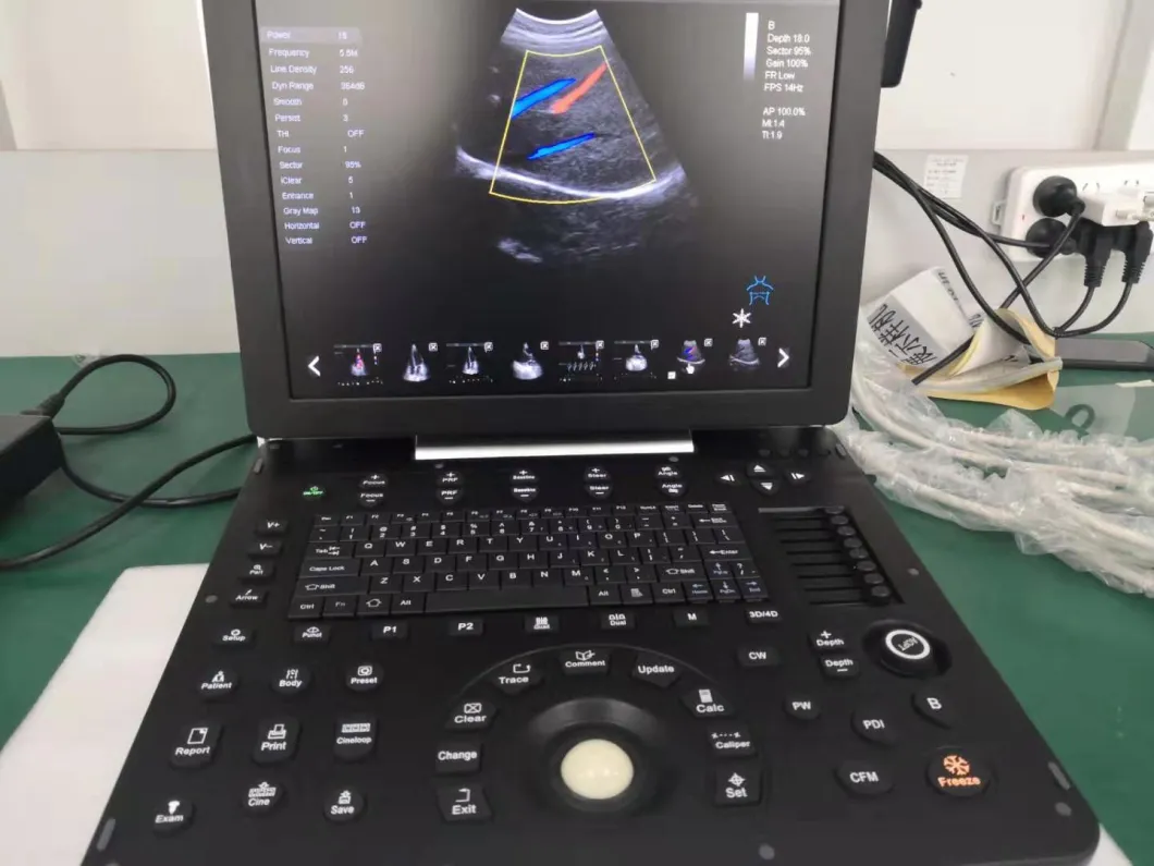 4D Color Ultrasound Doppler Probe Machine