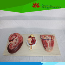 Kidney Model: Renal Nephron and Renal Corpuscle