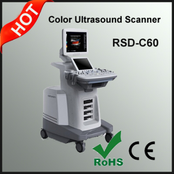 Color Ultrasonic Diagnostic System