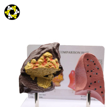 Fully Stocked Human Kidney Medical Teaching Model - Anatomical