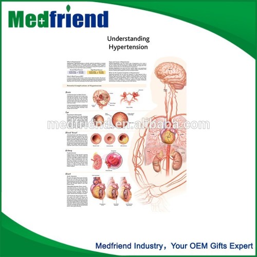 Low Cost High Quality Understanding Hypertension Chart