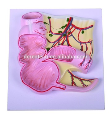 Human anatomical Ileocecal model