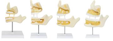 Tooth developmental model
