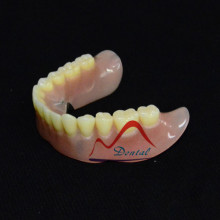 Acrylic Removable Full Denture
